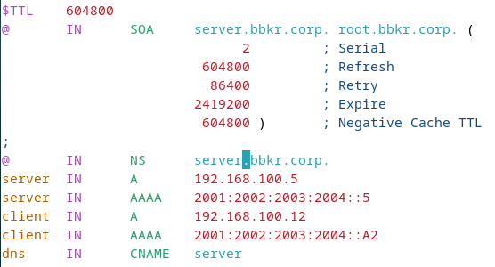 DNS Forward Zone Configuration